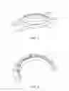 Fig. 04 - TITANIUM SINTERED BODY AND ORNAMENT