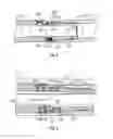 Fig. 04 - Drilling apparatus using a self-adjusting deflection device and deflection sensors for drilling directional wells