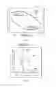 Fig. 04 - Digital internal combustion engine and method of control