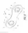 Fig. 14 - Bicycle chain