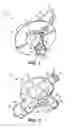 Fig. 02 - Stopcock with detents