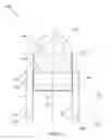 Fig. 02 - Systems and methods for a pipeline anchor lug sleeve and link