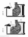 Fig. 11 - Bagless event ice system