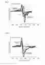 Fig. 06 - Analysis method for obtaining XPS and AES and elements in each chemical bonding state and X-ray photoelectron spectroscope for same