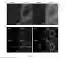 Fig. 07 - Compositions and methods utilizing lysophosphatidylcholine scaffolds