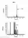 Fig. 01 - Methods of Determining Efficacy of Therapy For Niemann-Pick C Disease And Related Disorders