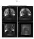 Fig. 04 - Methods and devices for imaging large intact tissue samples