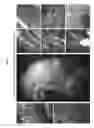 Fig. 05 - Methods and devices for imaging large intact tissue samples