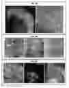 Fig. 06 - Methods and devices for imaging large intact tissue samples