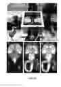 Fig. 14 - Methods and devices for imaging large intact tissue samples