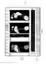 Fig. 04 - Methods and apparatuses for designing footwear