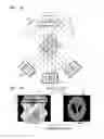 Fig. 05 - Tomography apparatus and method of reconstructing cross-sectional image