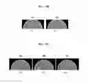 Fig. 11 - Tomography apparatus and method of reconstructing cross-sectional image