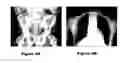 Fig. 05 - Training system for detection and classification of artificial objects in X-ray images