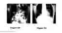 Fig. 06 - Training system for detection and classification of artificial objects in X-ray images