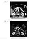 Fig. 08 - Medical image processing apparatus, medical image processing method, and medical image processing system