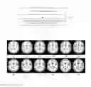 Fig. 02 - METHOD AND DEVICE FOR CONSTRUCTING BRAIN TEMPLATES