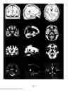 Fig. 03 - METHOD AND DEVICE FOR CONSTRUCTING BRAIN TEMPLATES