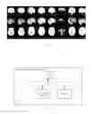 Fig. 05 - METHOD AND DEVICE FOR CONSTRUCTING BRAIN TEMPLATES