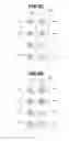 Fig. 10 - Register error amount detection method and apparatus
