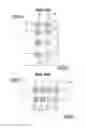 Fig. 11 - Register error amount detection method and apparatus