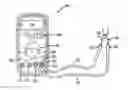 Fig. 01 - Measurement device and method