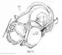 Fig. 18 - Birthing simulation devices, systems, and methods