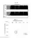 Fig. 10 - Organic light emitting display device and method of manufacturing the same