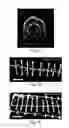 Fig. 12 - Methods and systems for scaffolds comprising nanoelectronic components