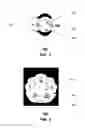 Fig. 03 - Transmission medium having multiple cores and methods for use therewith