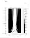 Fig. 13 - Wireless power transfer using tunable metamaterial systems and methods