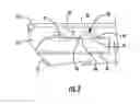 Fig. 04 - Electronic device including acoustically isolated passive radiator within a baffle space and related methods