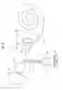 Fig. 03 - Implantable middle ear transducer having improved frequency response