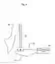 Fig. 05 - Implantable middle ear transducer having improved frequency response