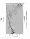 Fig. 09 - Implantable middle ear transducer having improved frequency response
