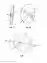 Fig. 05 - Sealing earpiece