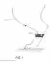 Fig. 02 - Conformable and reusable lick deterrent
