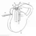 Fig. 01 - Retractable leash system