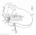 Fig. 02 - Retractable leash system