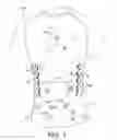 Fig. 02 - Apparel item configured for reduced cling perception