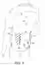 Fig. 05 - Apparel item configured for reduced cling perception
