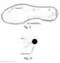 Fig. 05 - Massage shoe