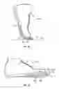Fig. 13 - Sole structure for an article of footwear with extended plate