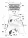 Fig. 11 - Method of manufacturing article of footwear with graduated projections
