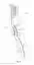 Fig. 06 - Toothbrush with angled bristles