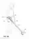 Fig. 09 - Handheld vacuum cleaner