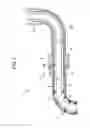 Fig. 03 - GUIDING DEVICE AND SURGICAL SYSTEM