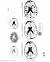 Fig. 07 - Framework for Abnormality Detection in Multi-Contrast Brain Magnetic Resonance Data