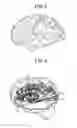 Fig. 03 - Magnetic resonance imaging apparatus and image processing apparatus