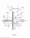 Fig. 15 - OPTICAL SENSOR FOR A CATHETER
